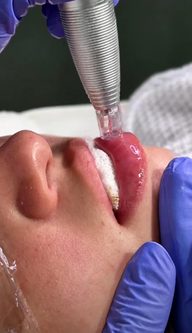 Tratamiento Hydra Lips de hidratación profunda de labios